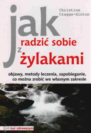 Jak radzić sobie z żylakami? Christine Craggs-Hinton
